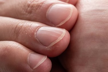 why nails have ridges