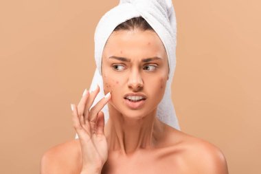 10 Effective Skincare Routine For Acne Prone Skin